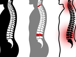 肩周炎,肩周炎的症狀,肩周炎疼痛怎麼辦,肩膀疼，肩膀疼就是肩周炎？除了肩周炎還要小心這些病