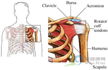 中年人如何防治肩周炎