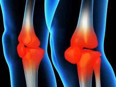 膝關節疼痛的七大原因及處理辦法