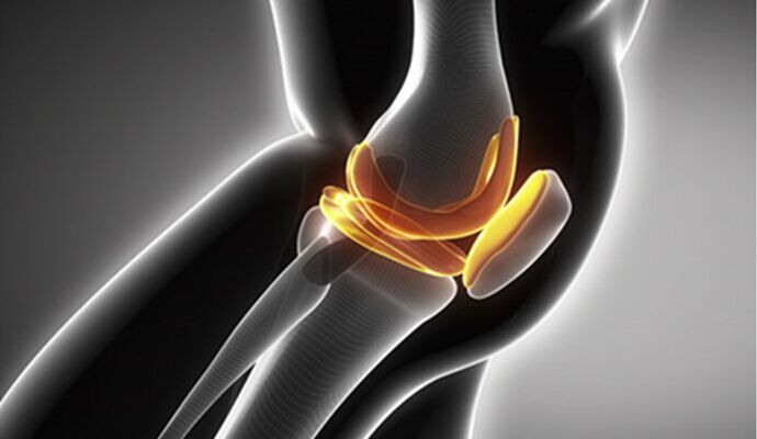 膝關節炎的治療方 減輕膝關節炎要做好什麼