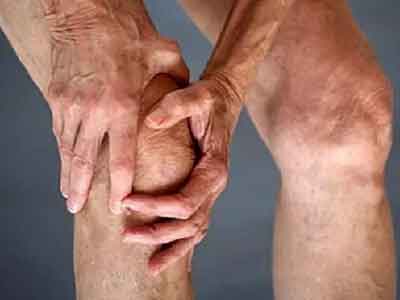 膝關節炎的自測六式