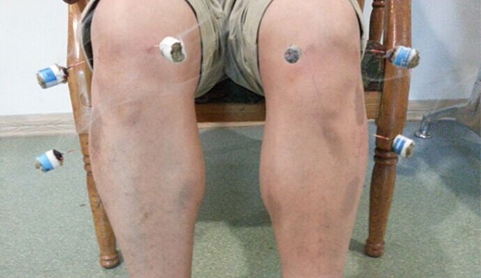 膝關節炎怎麼檢查與治療？