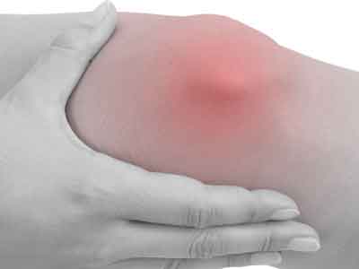 關節腫脹暗示膝關節炎 預防關節炎需減輕體重