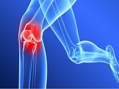 造成膝關節炎復發的原因