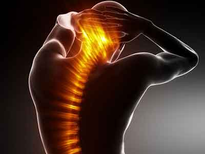 脊椎退行性病變是“鐵的規律”嗎