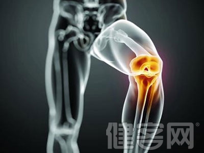 膝關節炎症狀有什麼