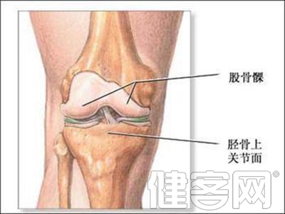 美國專家：關節炎患者要注意保護心血管