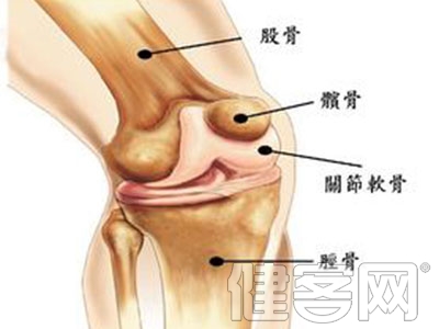 膝關節骨性關節炎