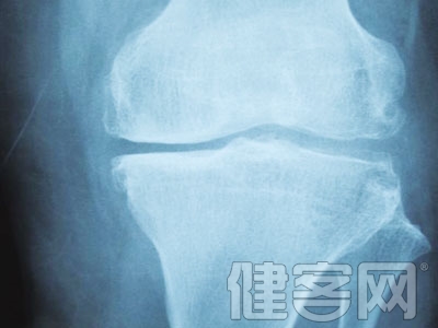 膝關節骨性關節炎該怎樣治療與預防