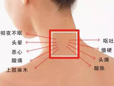 下肢無力手指發麻或因頸椎病 日常生活中如何預防頸椎病？