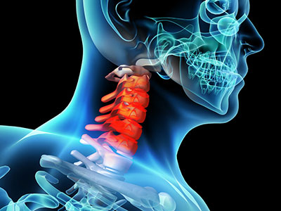 頸椎病用什麼方法可以治愈呢？