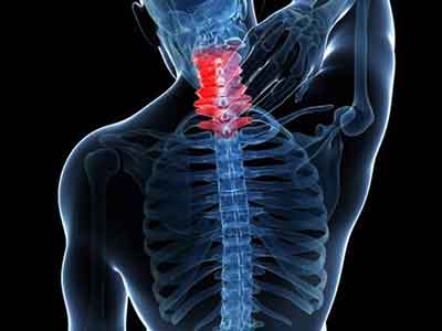 上肢麻木是頸椎病在作祟 如何保護好自己的頸椎？