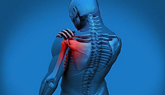 哪些臨近部位的疾病會引發肩周炎