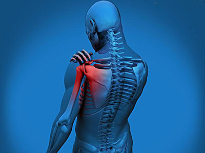 上班族高發肩周炎 健身操6步驟拯救你的肩