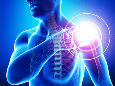 肩周炎有什麼症狀?