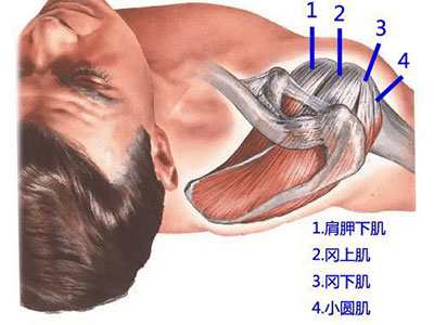 一招辨別肩痛是不是“肩周炎”