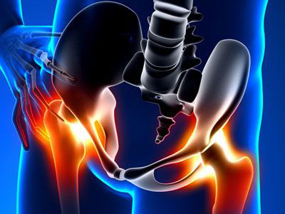 不穩定骨盆骨折處理的幾個關鍵問題