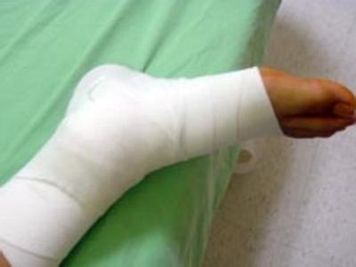 踝部骨折應該如何護理 預防骨骼畸形