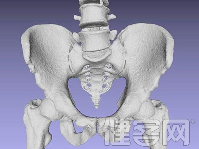 骨盆骨折患者易殘疾 骨盆骨折並發症有哪些