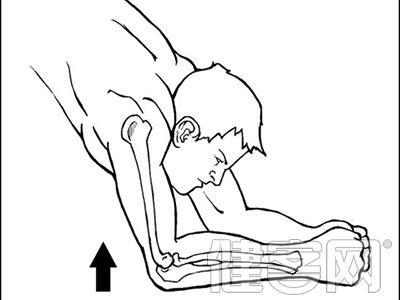 上臂骨折的康復鍛煉