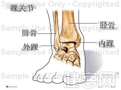 腳部扭傷的正確處理方法