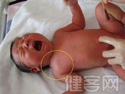 剛出生的寶寶為何會骨折