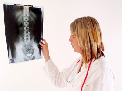 骨質增生通常的具體表現 骨質增生的檢查方法介紹