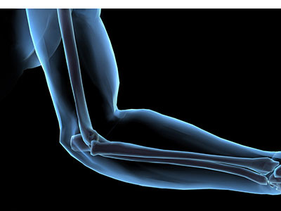 膝關節骨質增生發炎治療方法