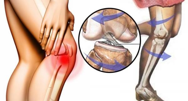膝關節有彈響是不是骨質增生