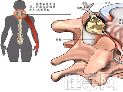 引起骨質增生的病因有哪些？