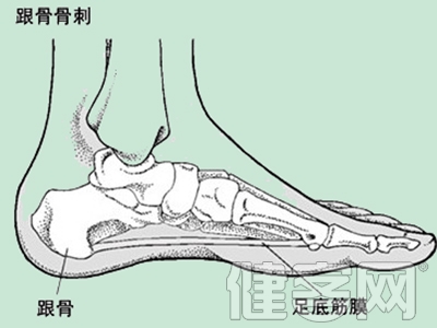 骨質增生的人吃什麼更好