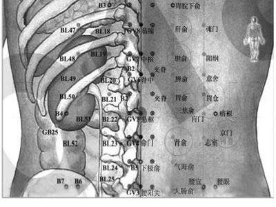 從各個方向為你解答腰肌勞損