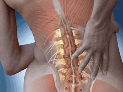 腰肌勞損病出有因，早發現早預防