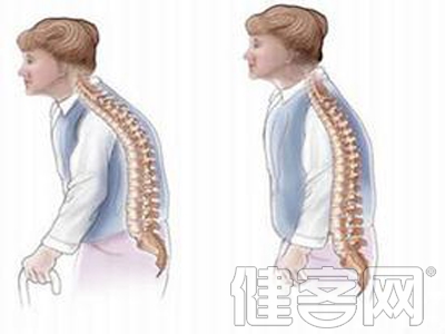 幾種常見的急性腰扭傷原因