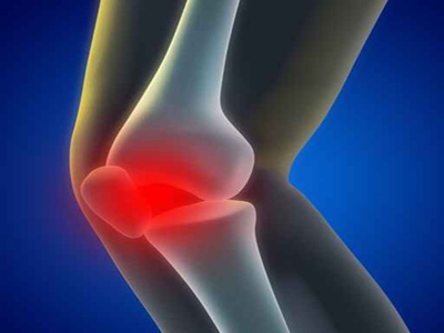 膝關節半月板損傷有哪些症狀表現？