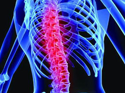 脊柱畸形症狀有哪些？