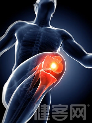 膝關節炎症狀有什麼？