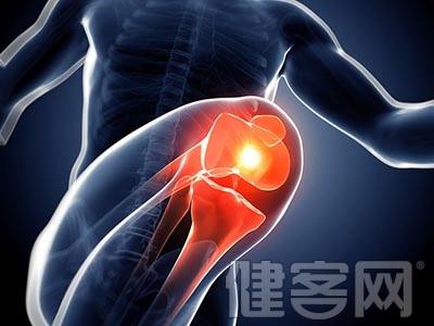 膝關節炎有哪些特征
