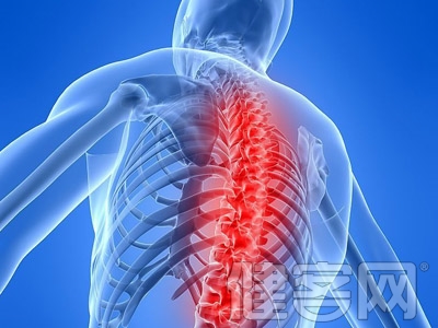 強直性脊柱炎常見症狀有哪些?