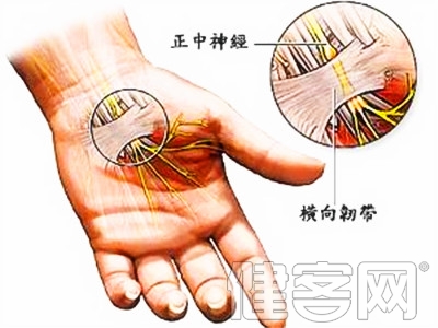 正確敲鍵盤可防腕管綜合征