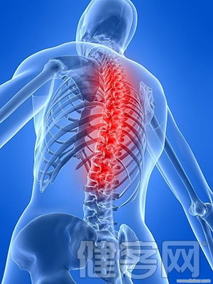 坐骨神經痛有哪些臨床症狀