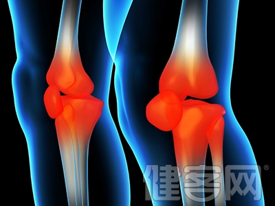 膝蓋骨質增生臨床症狀表現