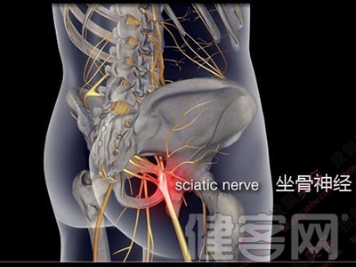 簡單方法自測腰椎間盤突出