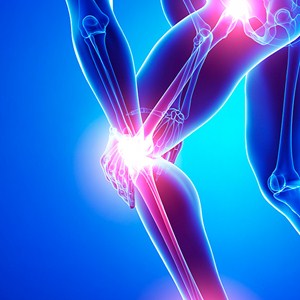 老年人膝關節疼痛的主要原因是什麼