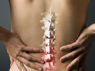 腰突為什麼會造成坐骨神經痛？