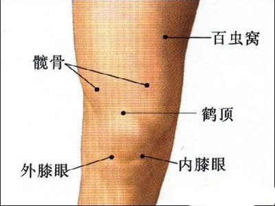 膝蓋不適常見的6種原因