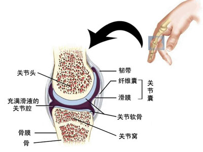 手指關節疼痛的原因是什麼