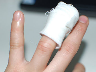 拇指腱鞘炎成因是什麼？