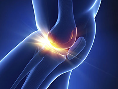 運動後膝前痛的原因是什麼？