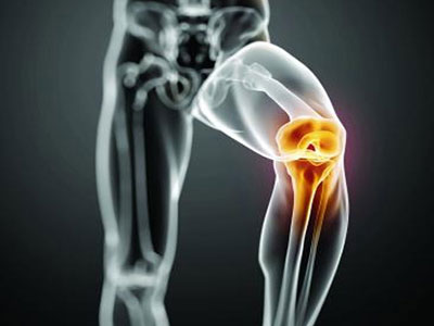 膝蓋骨痛有哪些原因